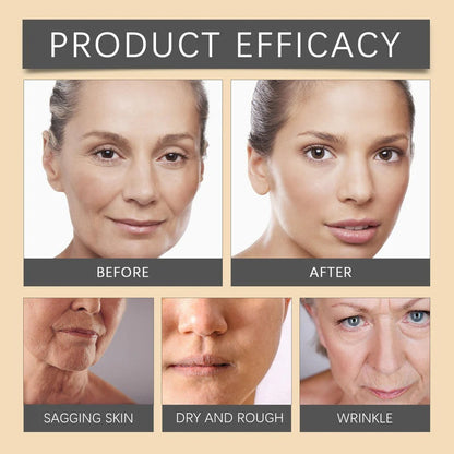 Bee Venom Botox Face Cream
